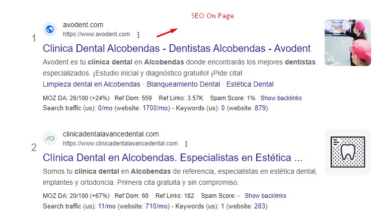 SEO on page clínica dental Alcobendas