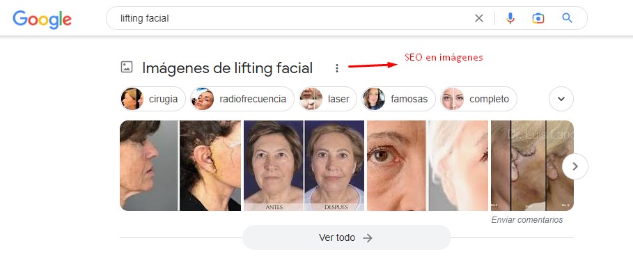 SEO en imágenes lifting facial